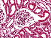 Kidney cortex glomerulus, LM