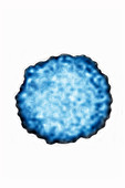 Flavivirus, TEM