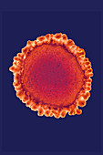 Flu virus, Orthomyxoviridae, TEM