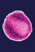 HIV virus, TEM