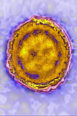 Herpes Simplex Virus 1, TEM