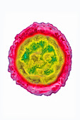 Herpes Simplex Virus 1, TEM