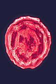 Herpes Simplex Virus 2, TEM