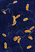 Vibrio cholera bacilli, LM