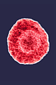 Herpes Simplex Virus 4, TEM