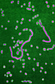 Haemophilus influenzae, LM