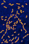 Bordetella pertussis, LM