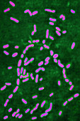 Bordetella pertussis, LM