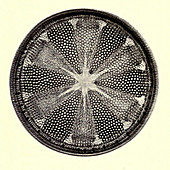 Diatom, Heliopelta Metil, Early Photomicrograph