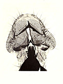 Proboscis of Blow-Fly, Early Photomicrograph