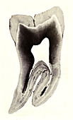 Human Tooth, Early Photomicrograph