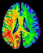 Enhanced Cadaver Cross Section of Brain