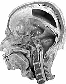 Head and Cranial Cavities