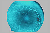 Fundus of the Eye
