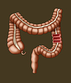 Healthy Large Intestine, Illustration