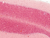 Cerebellum, human, LM