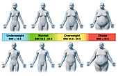 Body Mass Index, illustration
