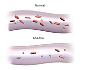 Red Blood Cells and Anaemia, Illustration