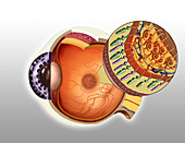 Macular Degeneration, Illustration