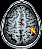 Sensory Task, fMRI