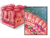 Celiac Disease, Intestinal Villi