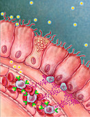 Celiac Disease, Intestinal Villi