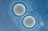 Sea Urchin Embryos