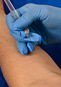Inserting IV needles