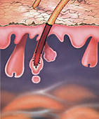 Hair follicle and skin, illustration