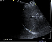 Normal spleen, ultrasound