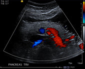 Normal pancreas, ultrasound