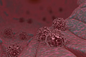 Cancer Cells, illustration