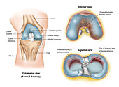 Injuries of the Patella, illustration