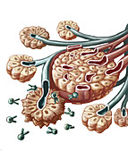Radioimmunotherapy, illustration
