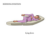 Lying Down Birthing Position, illustration
