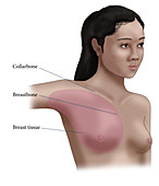 Breast Tissue, illustration