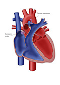 Newborn Heart, illustration
