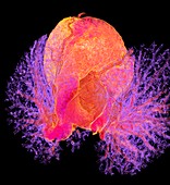 Human heart, 3D CT angiogram