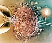 In vitro fertilisation, light micrograph