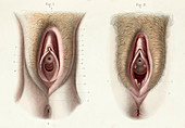 Female genitals, 1866 illustration
