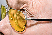 Glasses in ptosis