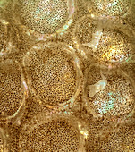 European plaice skin, polarised light micrograph