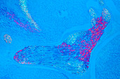 Section of male fern rhizome, polarised light micrograph