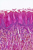Fungiform Papillae, LM