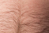 Hair on Male Stomach