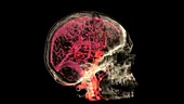 Blood Vessels of the Brain, MRI