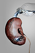 Hydration and Kidney Health