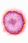 Mumps virus, TEM