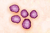 Measles Virus, TEM