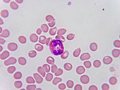 Eosinophilic leucocyte, LM